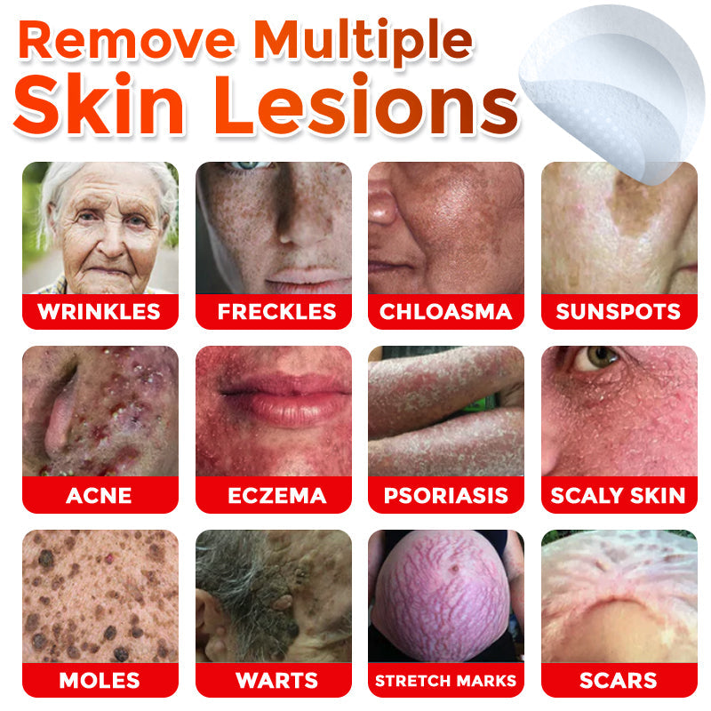 🌿 GFOUK® MicroNeedle Botanic Skin Tag Removal Patch 🇬🇧 Aligned with NHS Skincare Guidance